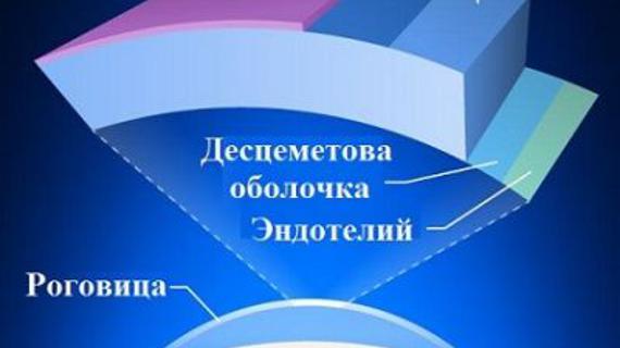 Превью картинка статьи Дистрофия роговицы глаза