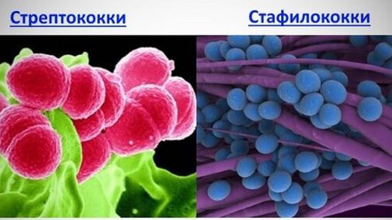 Превью картинка статьи Пиодермия: МКБ-10, фото, лечение, симптомы