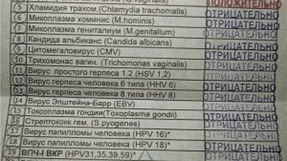 Превью картинка статьи Норма уреаплазмы у женщин: нормальные показатели в мазке, в анализах