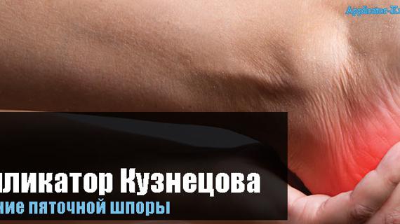 Превью картинка статьи от шпор на пятках в домашних условиях