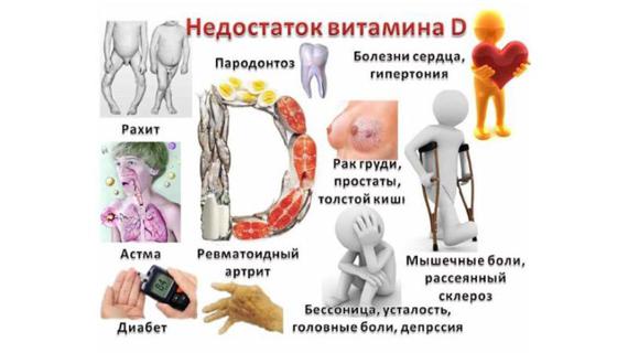 Превью картинка статьи Недостаток (дефицит) витамина Д у детей и взрослых: симптомы и к чему приводит нехватка, список кальцесодержащих препаратов