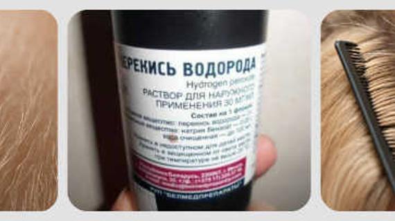Превью картинка статьи Перекись водорода от вшей и гнид на голове — рецепт, отзывы