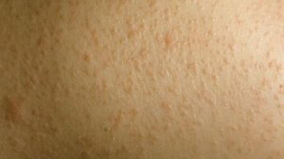 Превью картинка статьи Девержи и армия