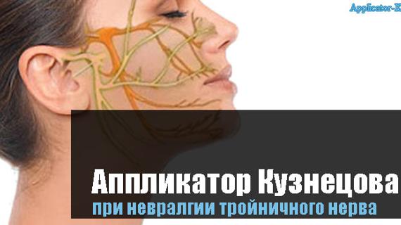 Превью картинка статьи при невралгии тройничного нерва
