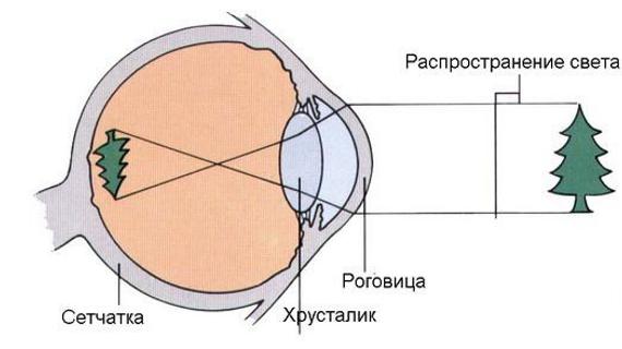 Превью картинка статьи Близорукость: лечение, причины, профилактика