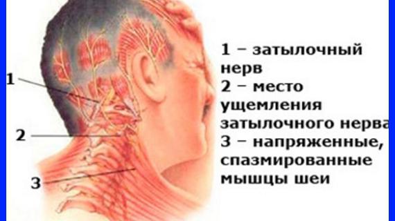 Превью картинка статьи Прямой лордоз шеи какую подушку выбрать